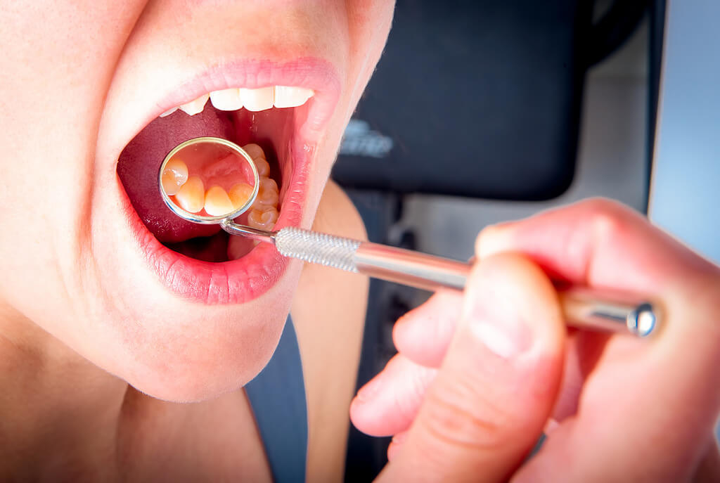 7 Cara Mengatasi Gigi Goyang dengan Bahan Alami (Terbukti Efektif)
