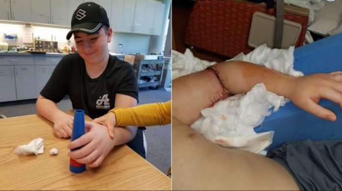 tangan_putus_doktersehat_1 tangan_putus_doktersehat_1