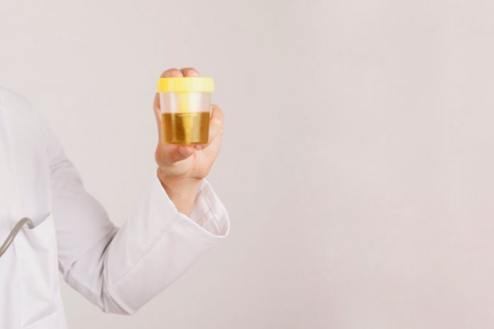warna-urine-penderita-ginjal-doktersehat