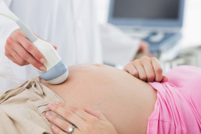 Ilustrasi-usg-bayi terlilit-tali-pusar-doktersehat Ilustrasi-usg-bayi terlilit-tali-pusar-doktersehat