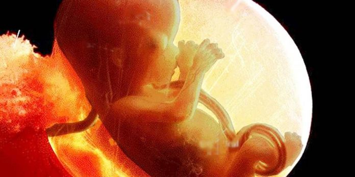 inilah-fungsi-air-ketuban-bagi-janin-doktersehat warna-dan-fungsi-air-ketuban-bagi-janin-doktersehat