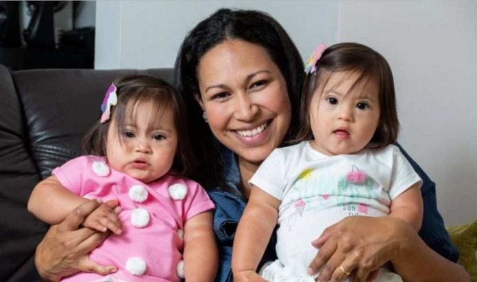 kembar_sindrom_down_doktersehat_1 kembar_sindrom_down_doktersehat_1