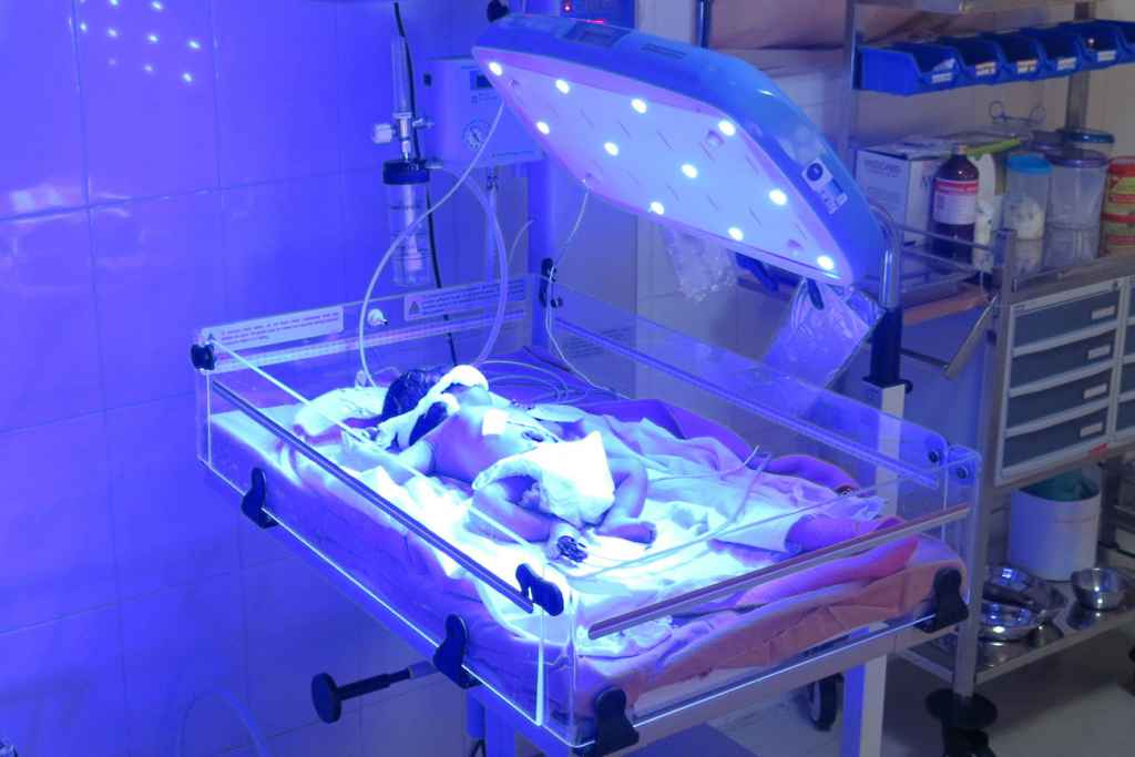 Manfaat dan Efek Fototerapi untuk Bayi Kuning