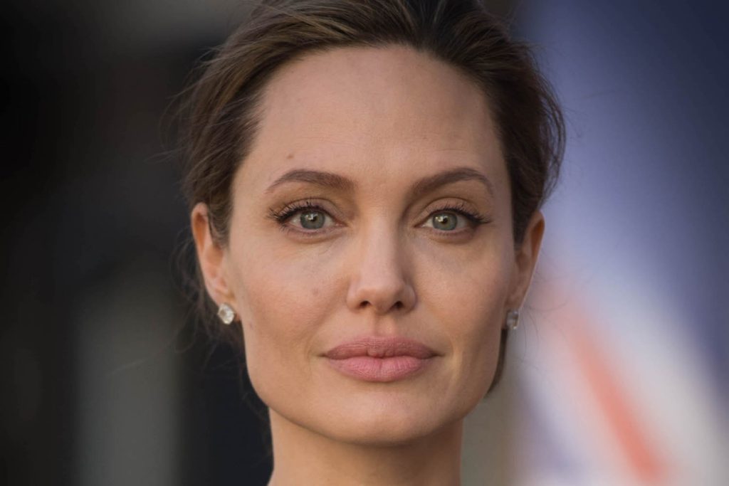 Cara Mengatasi Penyakit Bell’s Palsy yang Diderita Angelina Jolie