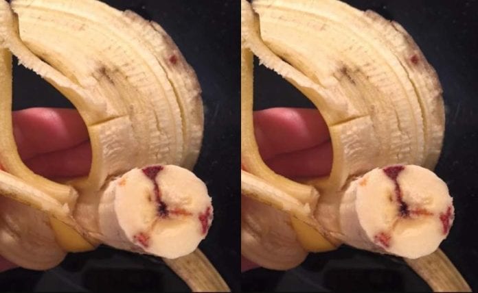 pisang_HIV_doktersehat_1