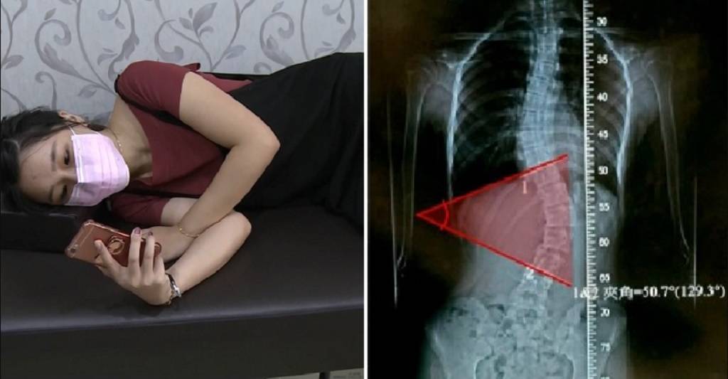 Sering Bermain Ponsel Sambil Tiduran, Tulang Punggung Gadis Ini Melengkung