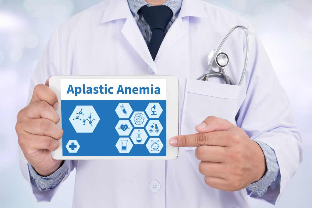 Anemia Aplastik: Penyebab, Gejala, dan Pengobatan