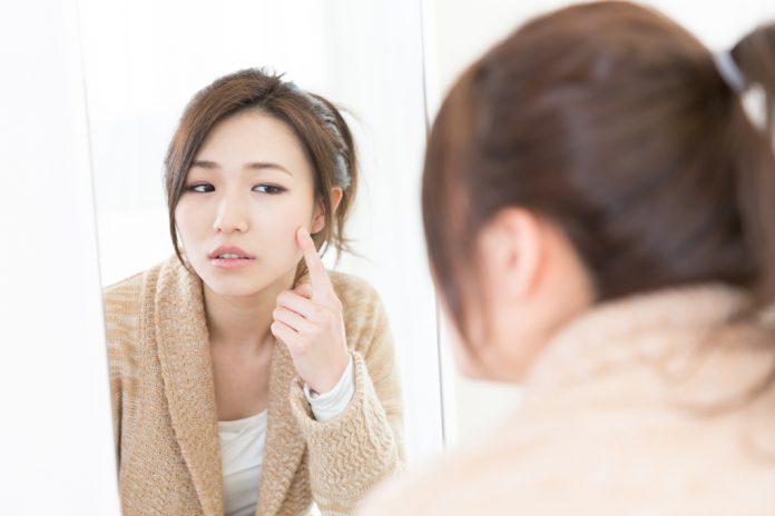 doktersehat jerawat hormonal doktersehat jerawat hormonal