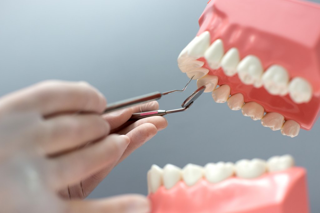 10 Penyebab Gigi Keropos dan Cara Mengatasinya