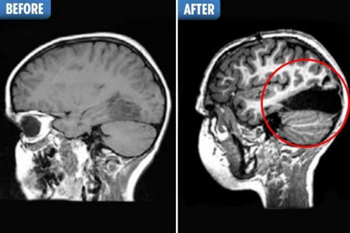 otak_epilepsi_doktersehat_1 otak_epilepsi_doktersehat_1