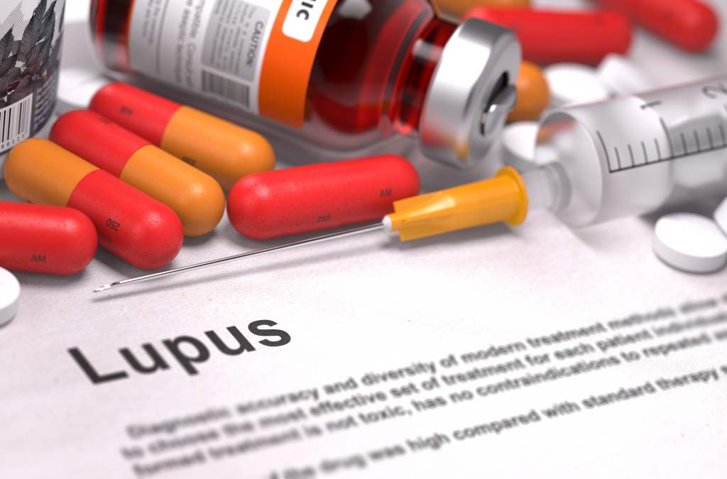 Penyakit Lupus: Jenis, Gejala, Penyebab, Obat, dll