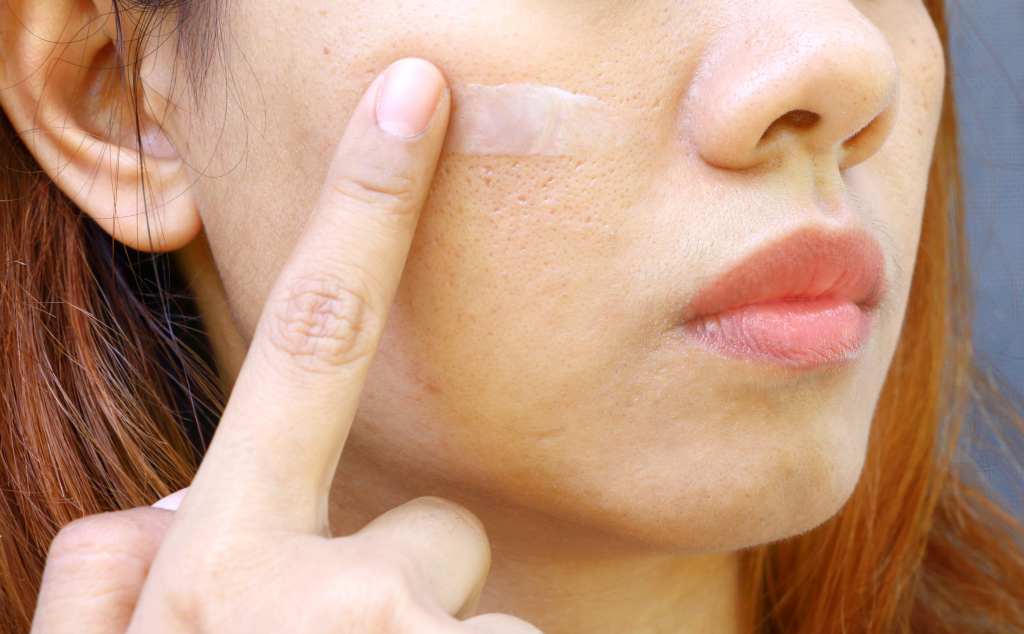 12 Cara Mengecilkan Pori-Pori Wajah yang Alami & Ampuh