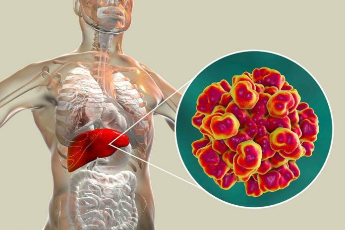 hepatitis-E-doktersehat