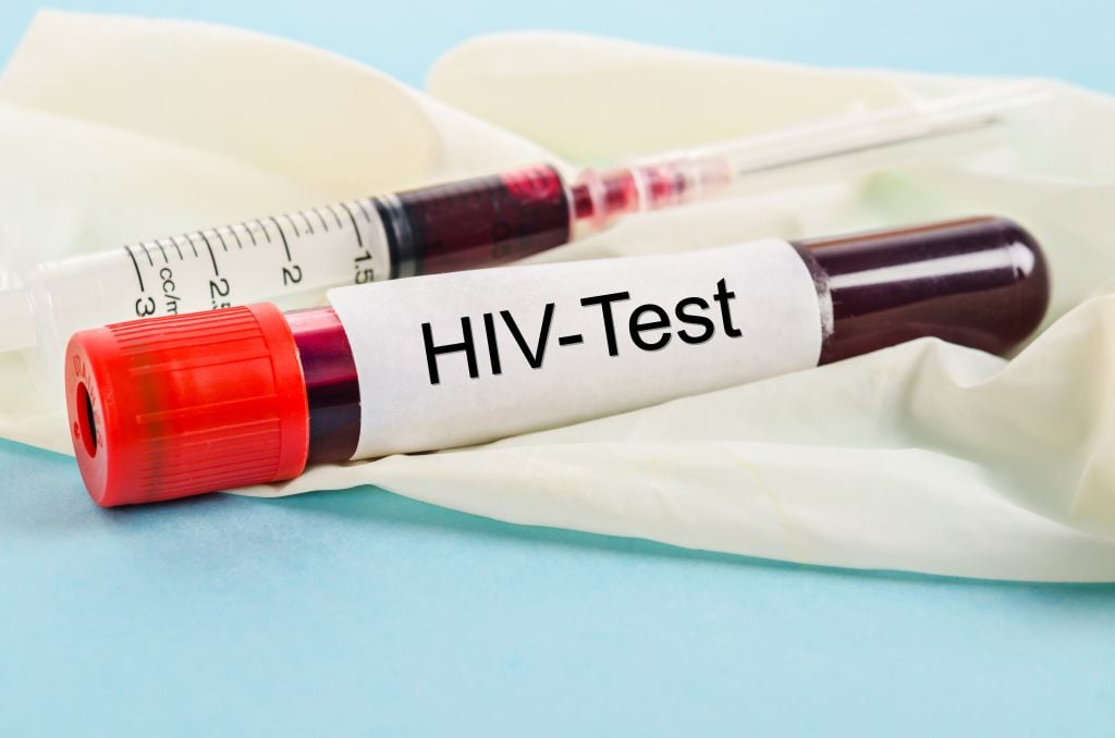 HIV/AIDS: Penyebab, Gejala, Diagnosis, Pengobatan, dan Pencegahan