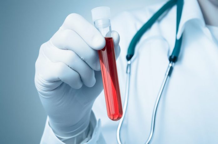 albumin-adalah-doktersehat