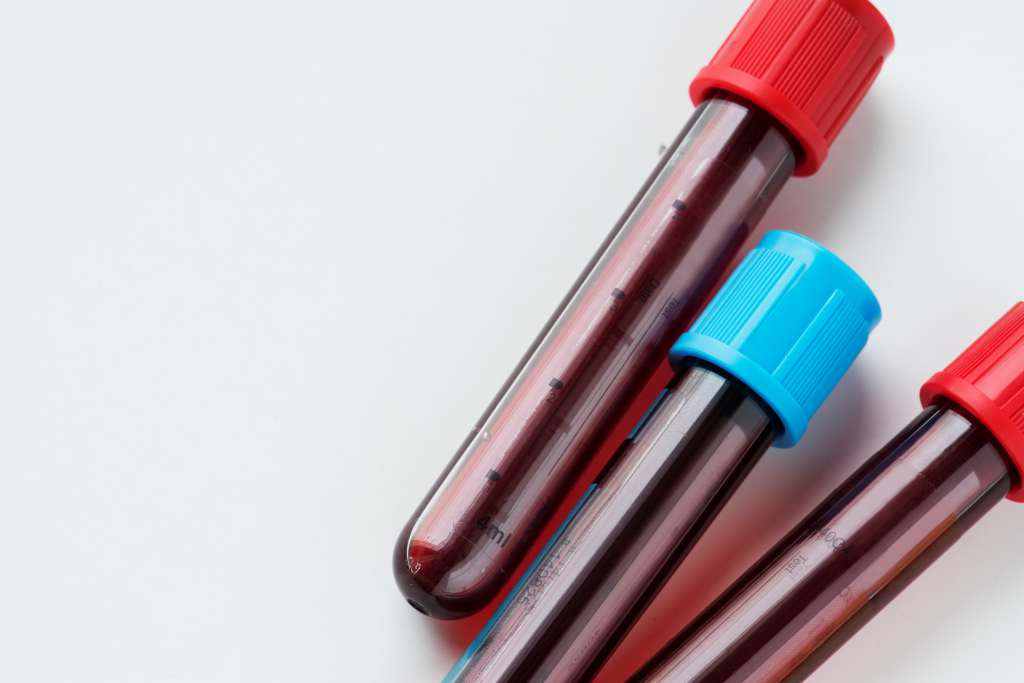 Eritrosit (Sel Darah Merah): Fungsi, Nilai Normal, Nilai Tidak Normal