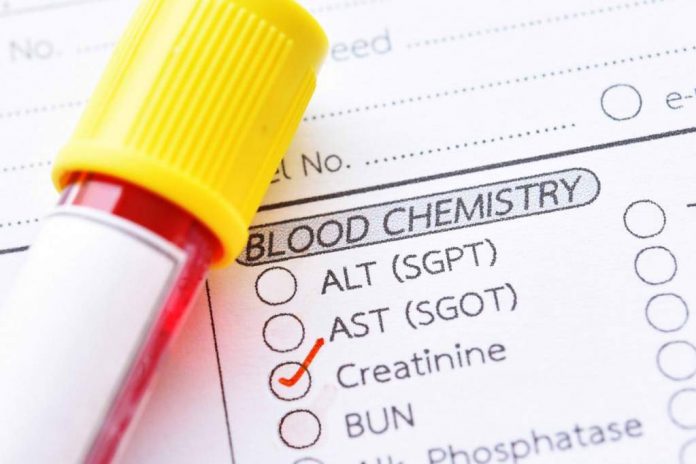 kreatinin-normal-doktersehat kreatinin-tinggi-doktersehat