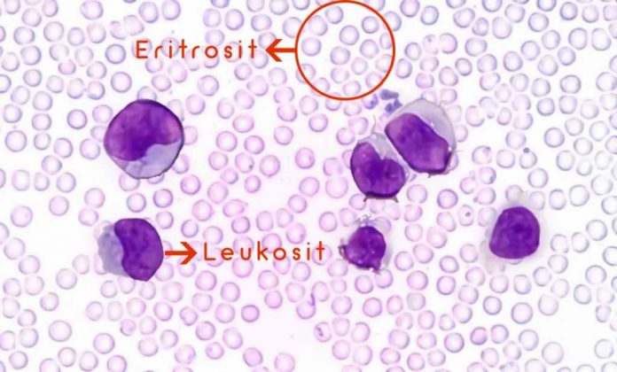 leukosit-doktersehat