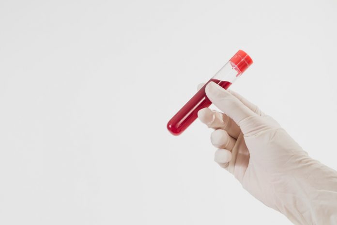 mch-adalah-doktersehat mch-adalah-doktersehat