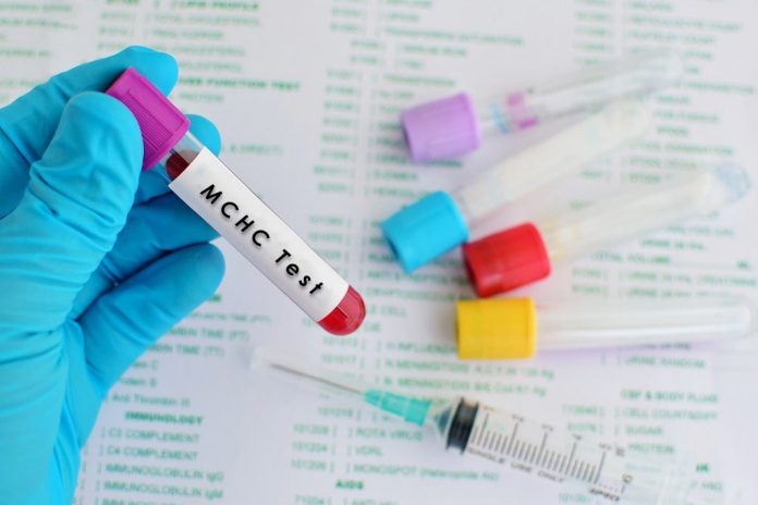 mchc-tinggi-doktersehat mchc-rendah-doktersehat
