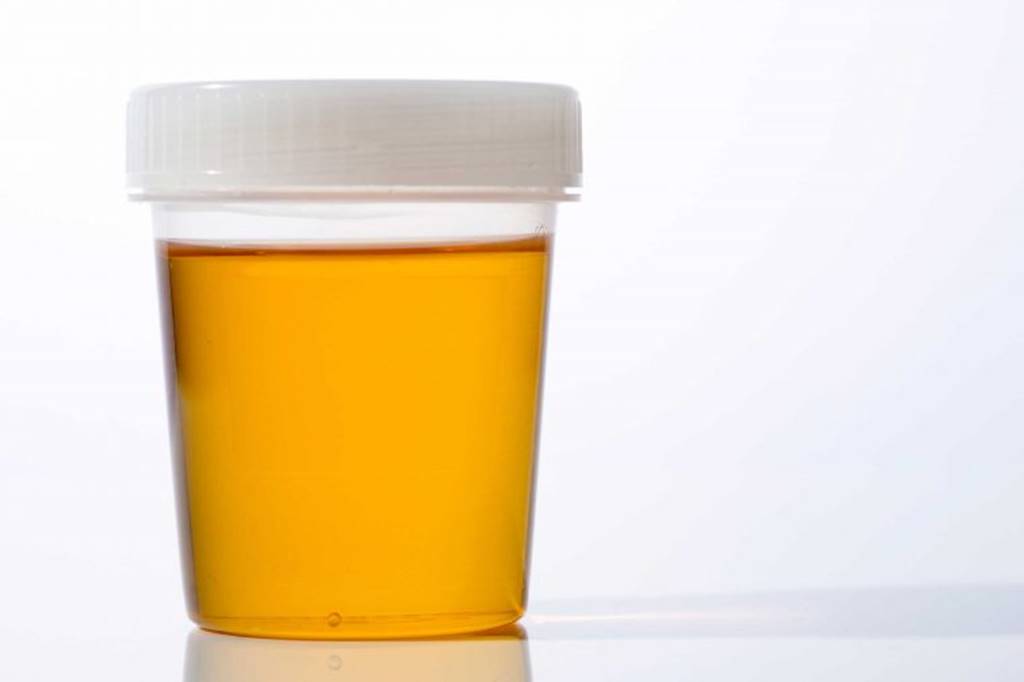 7 Jenis Warna Urine dan Arti Kesehatan di Baliknya