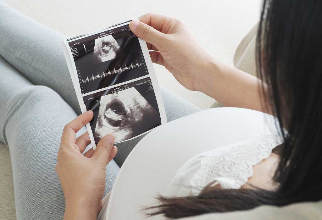 Cara Membaca Hasil USG Kehamilan yang Benar