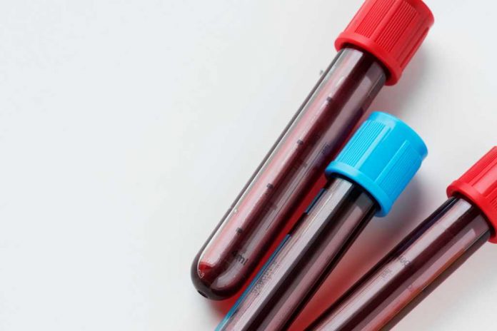 thalasemia-doktersehat