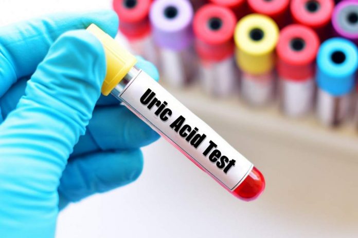 uric-acid-test-doktersehat normal-uric-acid-doktersehat
