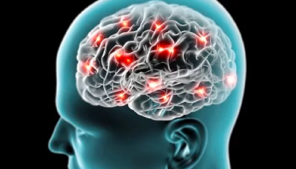 Epilepsi: Penyebab, Gejala, Diagnosis, dan Pengobatan