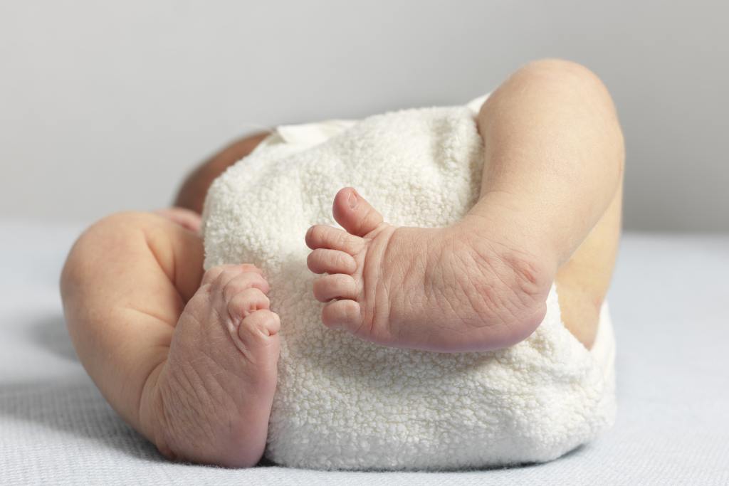 Penyebab Cacat Lahir pada Bayi dan Tips Pencegahannya
