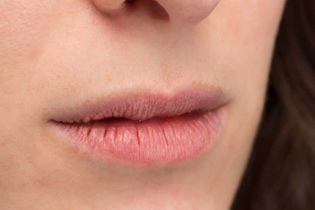 15 Cara Mengatasi Bibir Kering (Mudah dan Efektif)