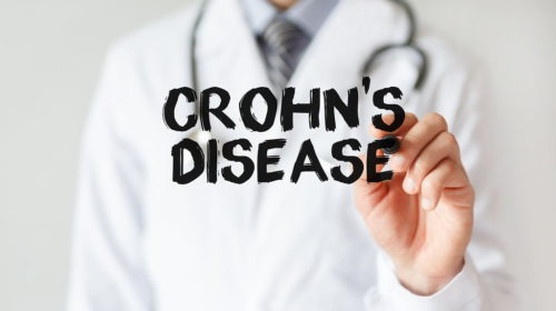 Crohn's Disease: Penyebab, Gejala, Dll