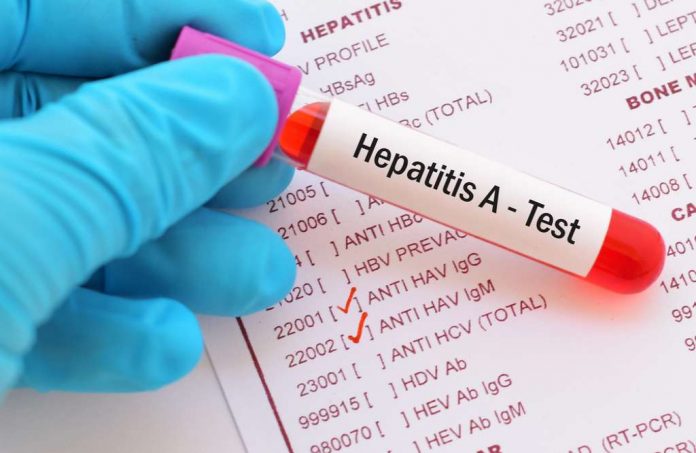 hepatitis-a-pacitan-doktersehat