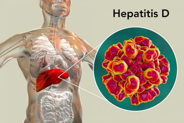 Mengenal Apa Itu Hepatitis A Penyebab Gejala Dan Cara