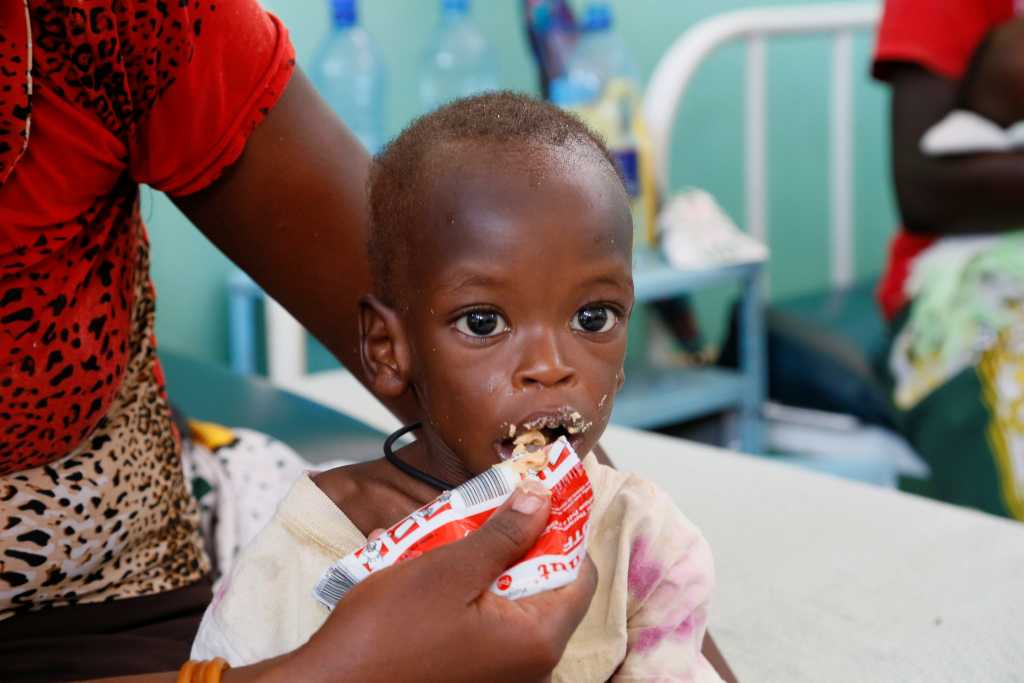 Malnutrisi: Penyebab, Jenis, Ciri-Ciri, Pengobatan