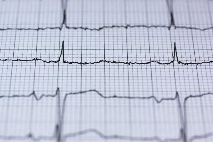 perbedaan-STEMI-dan-NSTEMI-doktersehat