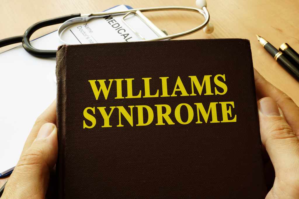 Williams Syndrome: Penyebab, Gejala, Cara Mengatasi
