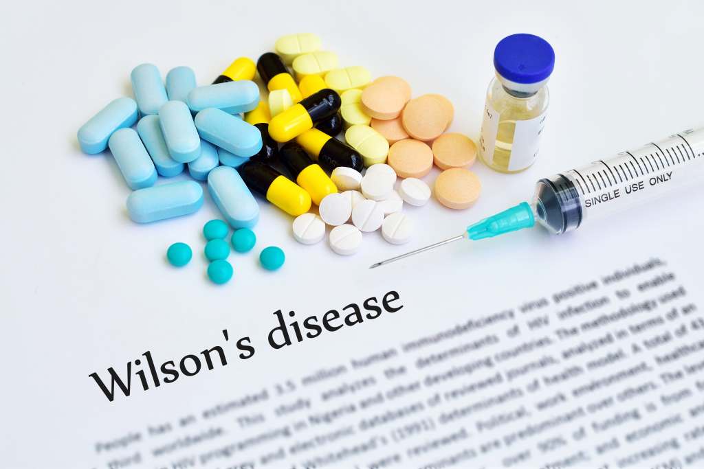 Penyakit Wilson: Penyebab, Gejala, Pengobatan, dll