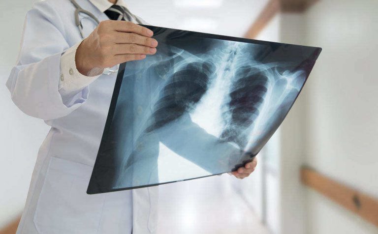 X Ray Kegunaan Cara Kerja Efek Samping DokterSehat