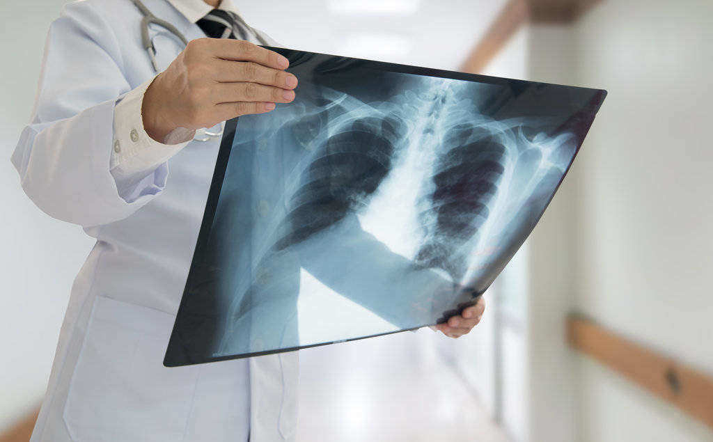 X-Ray: Kegunaan, Cara Kerja, Efek Samping