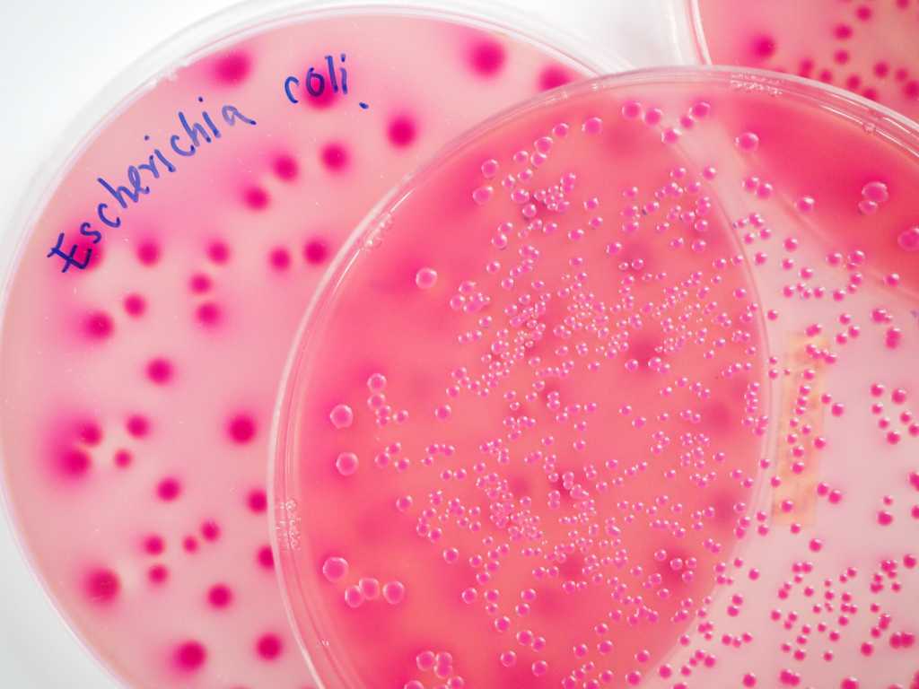Infeksi Bakteri E. Coli: Penyebab, Gejala, Pengobatan