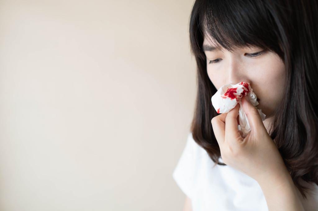 Hidung Berdarah: Penyebab, Pengobatan, Pencegahan, dll