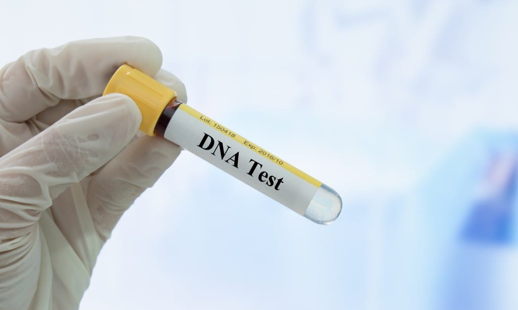 Tes DNA: Fungsi, Cara, Syarat, dan Biaya