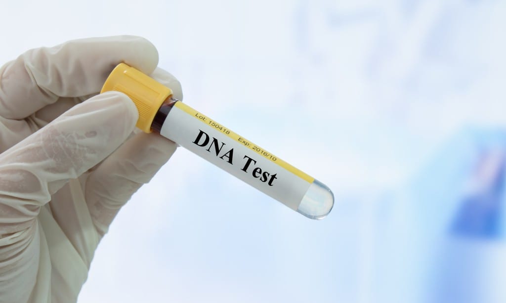 Tes DNA Fungsi Cara Syarat Dan Biaya DokterSehat