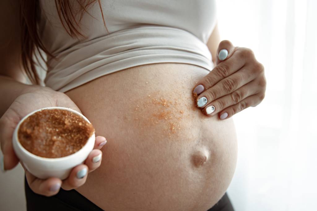 10 Cara Aman Mengatasi Stretch Mark saat Hamil