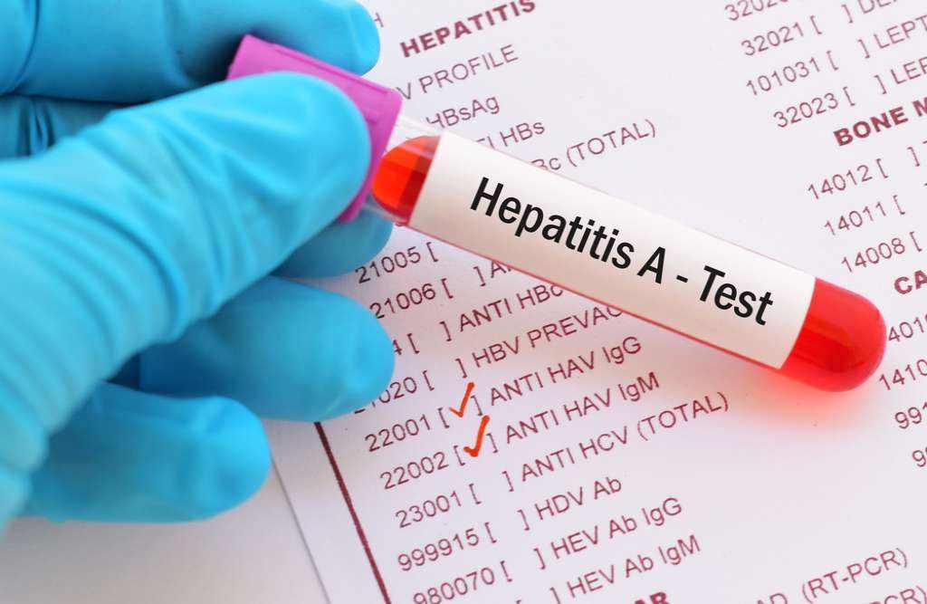 Kemenkes: Wabah Hepatitis A di Depok Berawal dari Petugas Kebersihan
