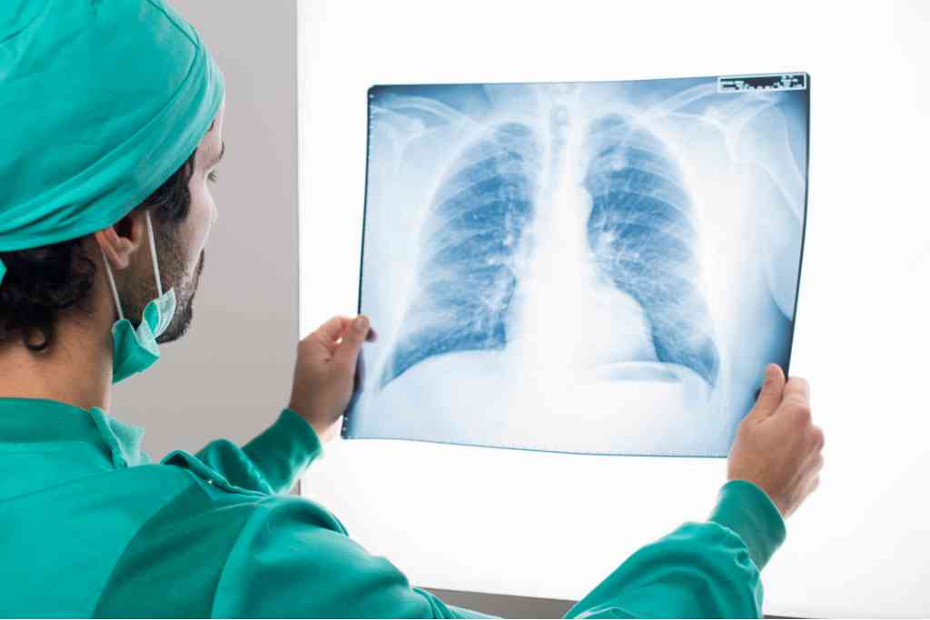 Kanker Paru-paru Stadium 2: Gejala, Penyebab, dan Pengobatan
