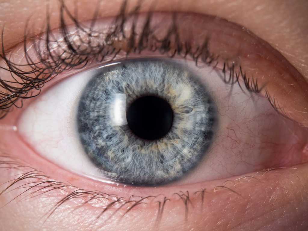 Kanker Mata: Gejala, Penyebab, Diagnosis, dan Pengobatan