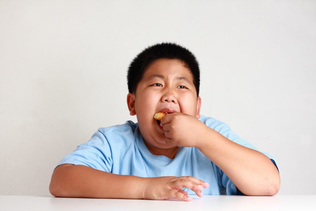 Obesitas pada Anak: Penyebab, Cara Mengatasi, Pencegahan, Dll