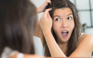 9 Penyebab Ketombe, Ternyata Bukan karena Rambut Kotor